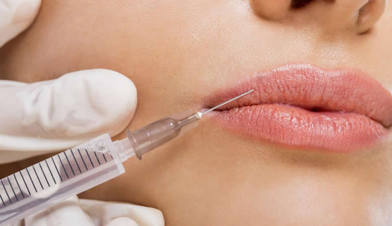 lip-fillers-botox-aesthetics-wirral