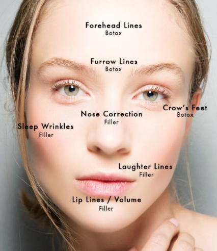 Areas For Botox
