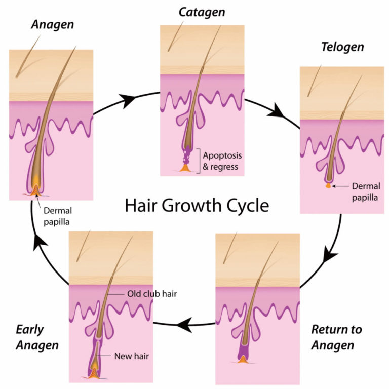 Wirral Laser Removal Permanent Wirral Laser Removal Permanent